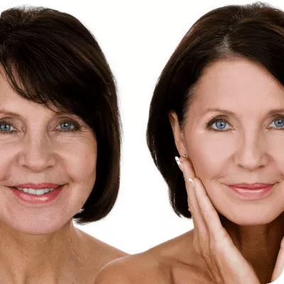 Skin Rejuvenation and Collagen-Building Treatments