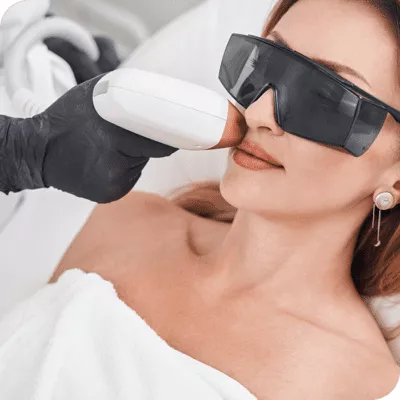 IPL and Laser Skin Treatments