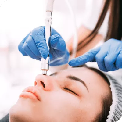 Microdermabrasion