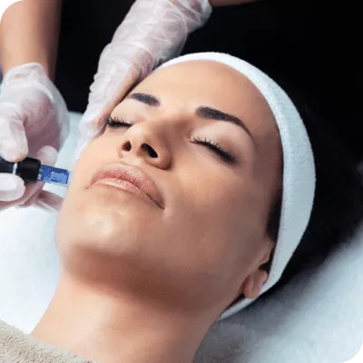 Microneedling