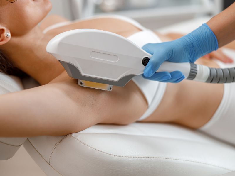 ipl hair removal image