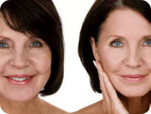 Skin Rejuvenation and Collagen-Building Treatments