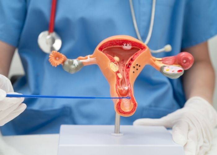 Vaginal Dryness Evaluation